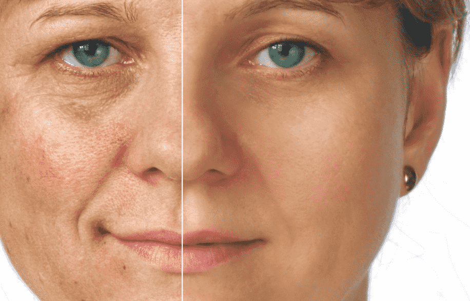 Как уплотнить кожу лица