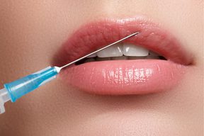 Как увеличить губы и скорректировать форму губ: способы, виды инъекций, побочные эффекты